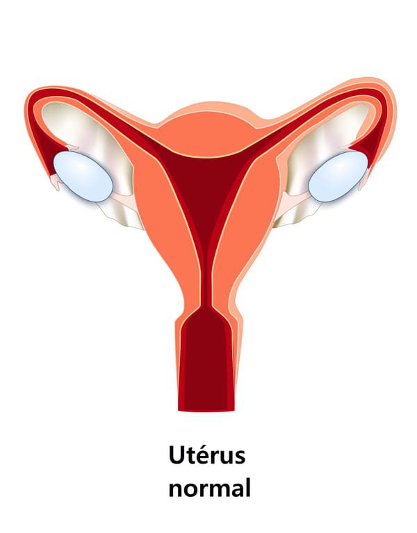 Utérus contractile : explication, causes, traitements 1
