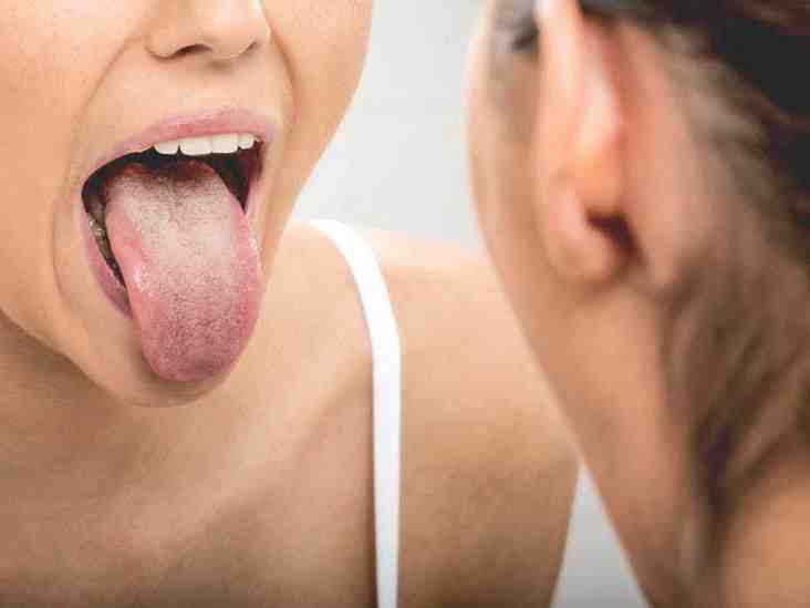 Quels sont les premiers symptômes du cancer de la langue ? 1