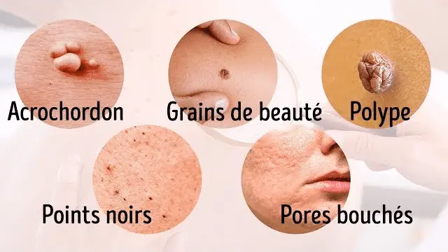 antibiotique chat combien de temps